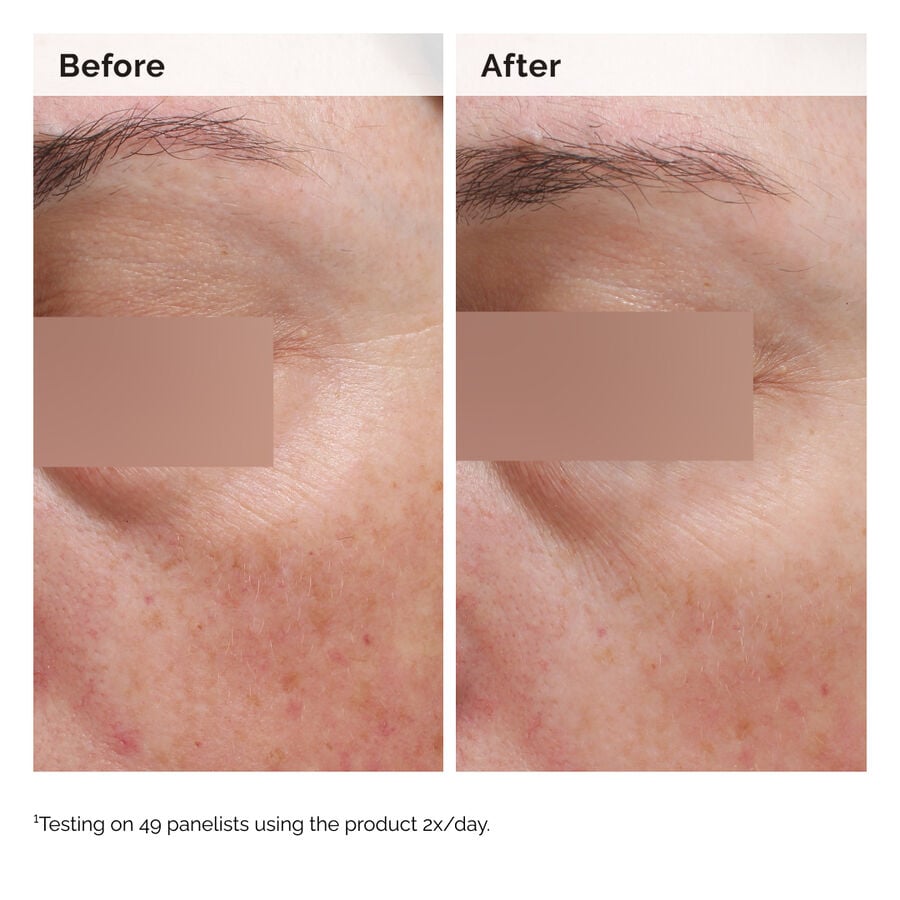 niacinamide-5-face-and-body-emulsion-y3 2024-08-23-ORD-Nia-5pct-Face-Body-B-A-Elasticity-Global-02-1x1.jpg