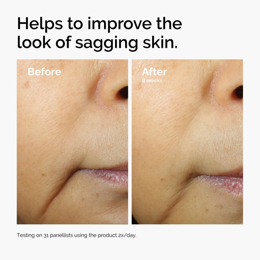 caffeine-3-escin-1-face-serum-o7 ord-caffeine-3pct-escin-1pct-face-serum-before-after-sagging.jpg