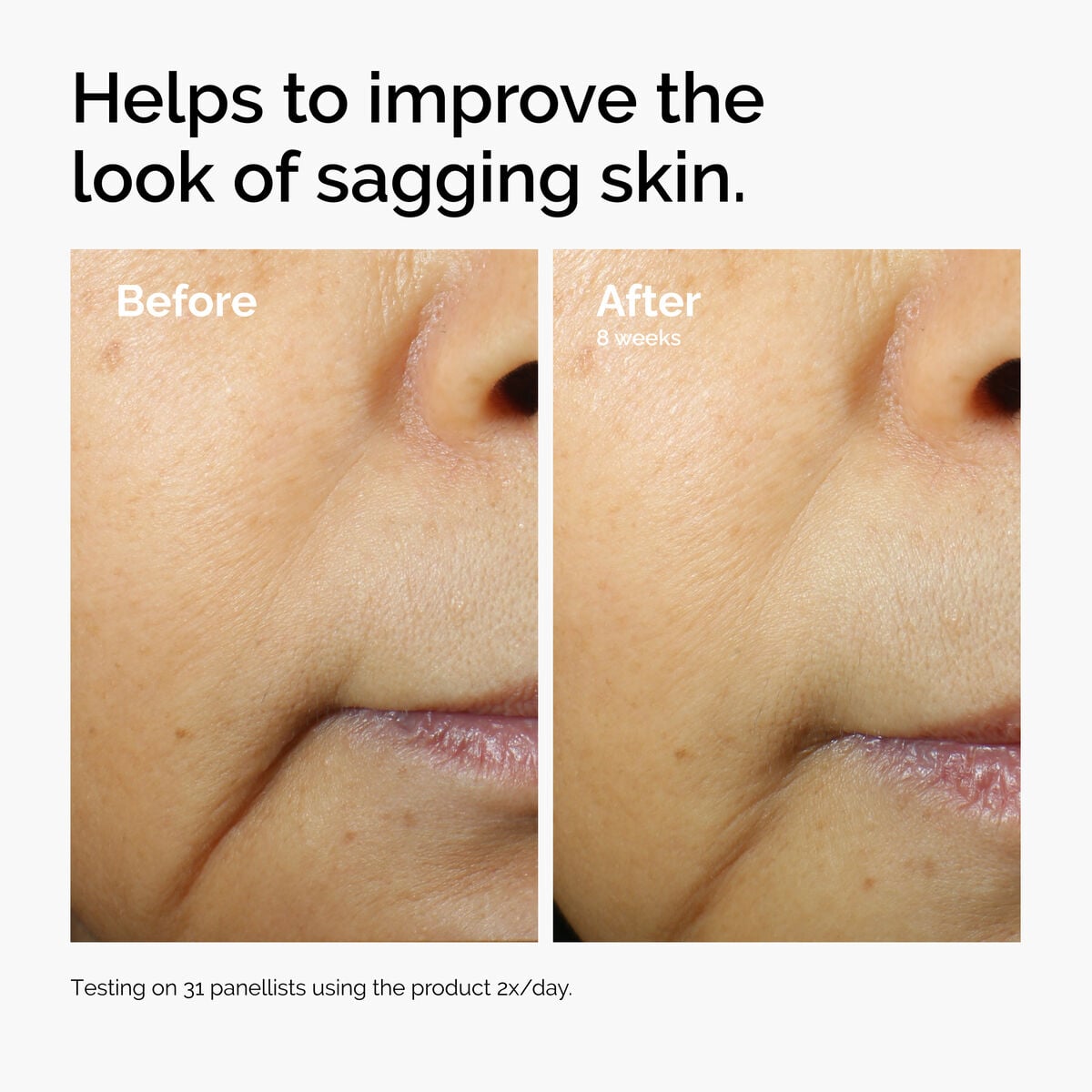 caffeine-3-escin-1-face-serum-o7 ord-caffeine-3pct-escin-1pct-face-serum-before-after-sagging.jpg