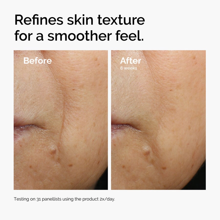 caffeine-3-escin-1-face-serum-o7 ord-caffeine-3pct-escin-1pct-face-serum-before-after-texture.jpg