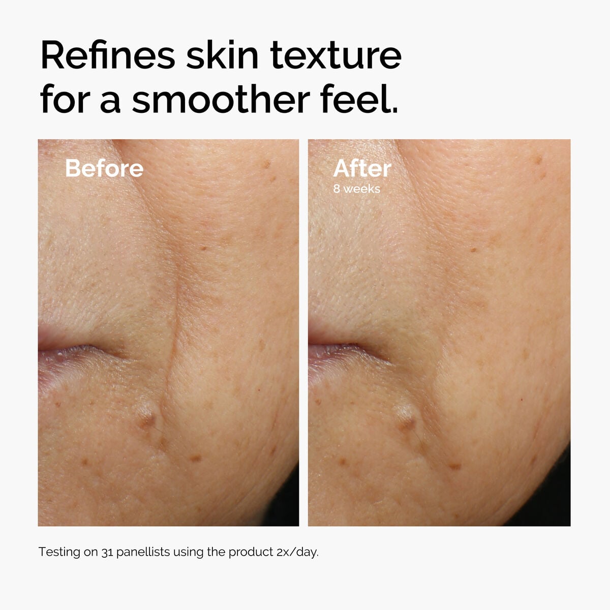 caffeine-3-escin-1-face-serum-o7 ord-caffeine-3pct-escin-1pct-face-serum-before-after-texture.jpg