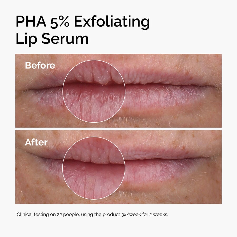 pha-5-exfoliating-lip-serum-d0 ord-pha-5pct-lip-exfoliating-serum-before-after.jpg